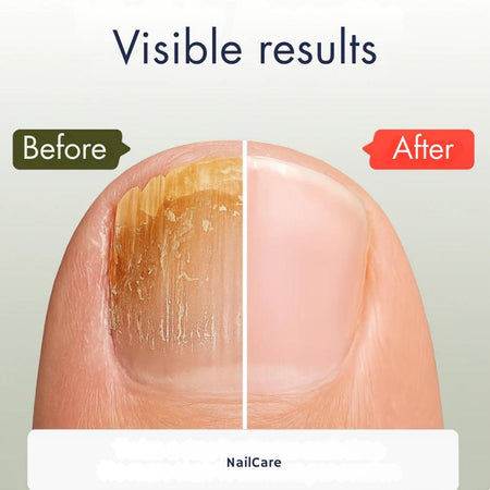 NailCare - Nail Repair Serum